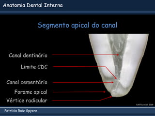 Patrícia Ruiz Spyere
Anatomia Dental Interna
Segmento apical do canal
CASTELLUCCI, 2009
Canal dentinário
Canal cementário
Limite CDC
Vértice radicular
Forame apical
 