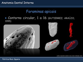 Patrícia Ruiz Spyere
Anatomia Dental Interna
Foraminas apicais
LOPES; SIQUEIRA JUNIOR; ELIAS, 2010; VERSIANI, 2014
 Contorno circular, 1 a 16 (GUTIERREZ; ARAÚJO,
1995)
 
