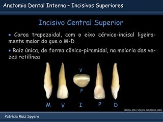 Patrícia Ruiz Spyere
Anatomia Dental Interna – Incisivos Superiores
Incisivo Central Superior
LEMOS, 2014; SOARES; GOLDBERG, 2002
 Coroa trapezoidal, com o eixo cérvico-incisal ligeira-
mente maior do que o M-D
 Raiz única, de forma cônico-piramidal, na maioria das ve-
zes retilínea
V P D
M I
V
P
 