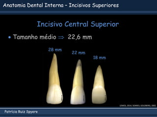 Patrícia Ruiz Spyere
Anatomia Dental Interna – Incisivos Superiores
Incisivo Central Superior
 Tamanho médio  22,6 mm
28 mm
LEMOS, 2014; SOARES; GOLDBERG, 2002
22 mm
18 mm
 