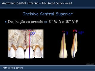 Patrícia Ruiz Spyere
Anatomia Dental Interna – Incisivos Superiores
Incisivo Central Superior
 Inclinação na arcada  3º M-D e 15º V-P
LEMOS, 2014
 