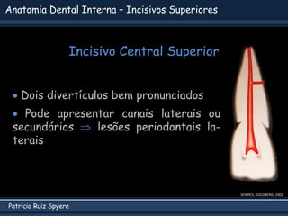 Patrícia Ruiz Spyere
SOARES; GOLDBERG, 2002
 Dois divertículos bem pronunciados
 Pode apresentar canais laterais ou
secundários  lesões periodontais la-
terais
Anatomia Dental Interna – Incisivos Superiores
Incisivo Central Superior
 