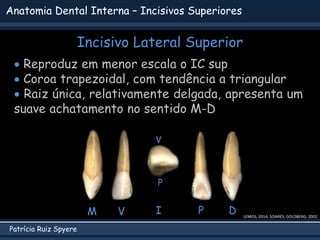 Patrícia Ruiz Spyere
Anatomia Dental Interna – Incisivos Superiores
Incisivo Lateral Superior
LEMOS, 2014; SOARES; GOLDBERG, 2002
 Reproduz em menor escala o IC sup
 Coroa trapezoidal, com tendência a triangular
 Raiz única, relativamente delgada, apresenta um
suave achatamento no sentido M-D
V P D
M I
V
P
 