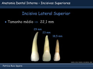 Patrícia Ruiz Spyere
Anatomia Dental Interna – Incisivos Superiores
Incisivo Lateral Superior
 Tamanho médio  22,1 mm
29 mm
LEMOS, 2014; SOARES; GOLDBERG, 2002
23 mm
18,5 mm
 