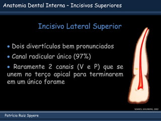 Patrícia Ruiz Spyere
SOARES; GOLDBERG, 2002
 Dois divertículos bem pronunciados
 Canal radicular único (97%)
 Raramente 2 canais (V e P) que se
unem no terço apical para terminarem
em um único forame
Anatomia Dental Interna – Incisivos Superiores
Incisivo Lateral Superior
 