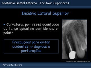 Patrícia Ruiz Spyere
Anatomia Dental Interna – Incisivos Superiores
CASTELLUCCI, 2009; SOARES; GOLDBERG, 2002
 Curvatura, por vezes acentuada
do terço apical no sentido disto-
palatal
Precauções para evitar
acidentes  degraus e
perfurações
Incisivo Lateral Superior
 