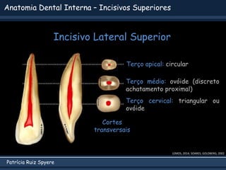 Patrícia Ruiz Spyere
Anatomia Dental Interna – Incisivos Superiores
Cortes
transversais
Terço apical: circular
Terço médio: ovóide (discreto
achatamento proximal)
Terço cervical: triangular ou
ovóide
LEMOS, 2014; SOARES; GOLDBERG, 2002
Incisivo Lateral Superior
 