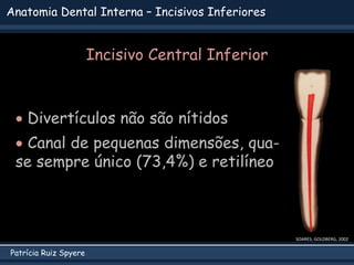 Patrícia Ruiz Spyere
SOARES; GOLDBERG, 2002
 Divertículos não são nítidos
 Canal de pequenas dimensões, qua-
se sempre único (73,4%) e retilíneo
Anatomia Dental Interna – Incisivos Inferiores
Incisivo Central Inferior
 