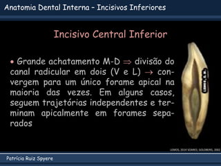 Patrícia Ruiz Spyere
Anatomia Dental Interna – Incisivos Inferiores
 Grande achatamento M-D  divisão do
canal radicular em dois (V e L)  con-
vergem para um único forame apical na
maioria das vezes. Em alguns casos,
seguem trajetórias independentes e ter-
minam apicalmente em forames sepa-
rados
Incisivo Central Inferior
LEMOS, 2014 SOARES; GOLDBERG, 2002
 