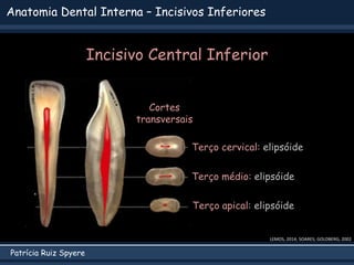 Patrícia Ruiz Spyere
Anatomia Dental Interna – Incisivos Inferiores
LEMOS, 2014; SOARES; GOLDBERG, 2002
Incisivo Central Inferior
Cortes
transversais
Terço apical: elipsóide
Terço médio: elipsóide
Terço cervical: elipsóide
 