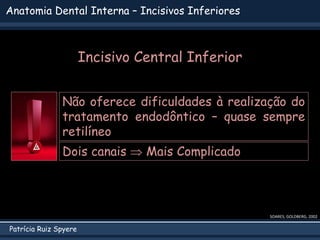 Patrícia Ruiz Spyere
Anatomia Dental Interna – Incisivos Inferiores
SOARES; GOLDBERG, 2002
Não oferece dificuldades à realização do
tratamento endodôntico – quase sempre
retilíneo
Dois canais  Mais Complicado
Incisivo Central Inferior
 