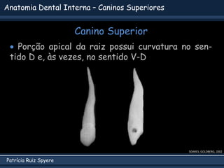 Patrícia Ruiz Spyere
Anatomia Dental Interna – Caninos Superiores
Canino Superior
SOARES; GOLDBERG, 2002
 Porção apical da raiz possui curvatura no sen-
tido D e, às vezes, no sentido V-D
 