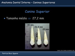 Patrícia Ruiz Spyere
Anatomia Dental Interna – Caninos Superiores
Canino Superior
 Tamanho médio  27,2 mm
38 mm
26,4 mm
20 mm
LEMOS, 2014; SOARES; GOLDBERG, 2002
 