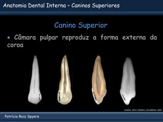 Patrícia Ruiz Spyere
Anatomia Dental Interna – Caninos Superiores
Canino Superior
LEMOS, 2014; SOARES; GOLDBERG, 2002
 Câmara pulpar reproduz a forma externa da
coroa
 