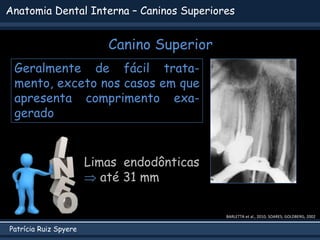 Patrícia Ruiz Spyere
Anatomia Dental Interna – Caninos Superiores
Canino Superior
BARLETTA et al., 2010; SOARES; GOLDBERG, 2002
Geralmente de fácil trata-
mento, exceto nos casos em que
apresenta comprimento exa-
gerado
Limas endodônticas
 até 31 mm
 