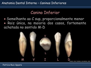 Patrícia Ruiz Spyere
Anatomia Dental Interna – Caninos Inferiores
Canino Inferior
 Semelhante ao C sup, proporcionalmente menor
 Raiz única, na maioria dos casos, fortemente
achatada no sentido M-D
V L D
M I
V
L
LEMOS, 2014; SOARES; GOLDBERG, 2002
 