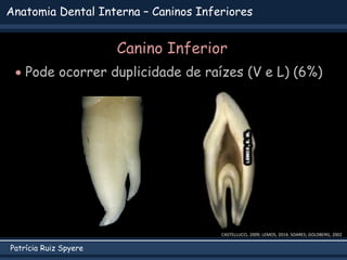 Patrícia Ruiz Spyere
Anatomia Dental Interna – Caninos Inferiores
Canino Inferior
 Pode ocorrer duplicidade de raízes (V e L) (6%)
CASTELLUCCI, 2009; LEMOS, 2014; SOARES; GOLDBERG, 2002
 