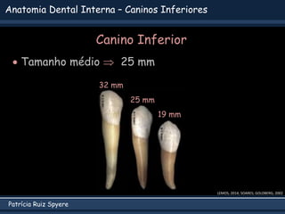 Patrícia Ruiz Spyere
Anatomia Dental Interna – Caninos Inferiores
Canino Inferior
 Tamanho médio  25 mm
LEMOS, 2014; SOARES; GOLDBERG, 2002
25 mm
19 mm
32 mm
 