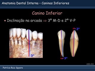 Patrícia Ruiz Spyere
Anatomia Dental Interna – Caninos Inferiores
Canino Inferior
 Inclinação na arcada  3º M-D e 2º V-P
LEMOS, 2014
 