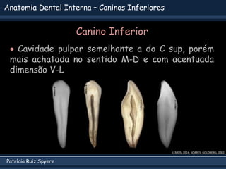 Patrícia Ruiz Spyere
Anatomia Dental Interna – Caninos Inferiores
Canino Inferior
 Cavidade pulpar semelhante a do C sup, porém
mais achatada no sentido M-D e com acentuada
dimensão V-L
LEMOS, 2014; SOARES; GOLDBERG, 2002
 