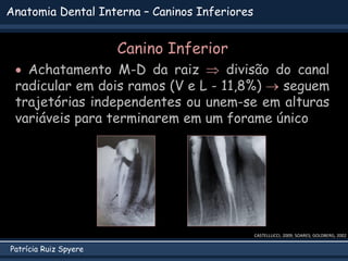  Achatamento M-D da raiz  divisão do canal
radicular em dois ramos (V e L - 11,8%)  seguem
trajetórias independentes ou unem-se em alturas
variáveis para terminarem em um forame único
Patrícia Ruiz Spyere
Anatomia Dental Interna – Caninos Inferiores
Canino Inferior
CASTELLUCCI, 2009; SOARES; GOLDBERG, 2002
 