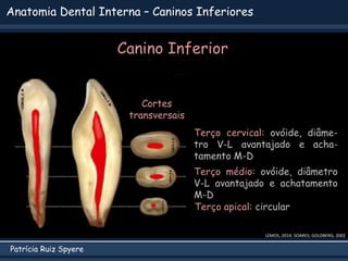 Patrícia Ruiz Spyere
Anatomia Dental Interna – Caninos Inferiores
Canino Inferior
LEMOS, 2014; SOARES; GOLDBERG, 2002
Cortes
transversais
Terço apical: circular
Terço médio: ovóide, diâmetro
V-L avantajado e achatamento
M-D
Terço cervical: ovóide, diâme-
tro V-L avantajado e acha-
tamento M-D
 