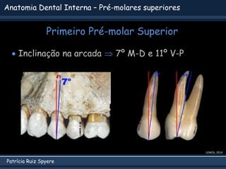 Patrícia Ruiz Spyere
Anatomia Dental Interna – Pré-molares superiores
Primeiro Pré-molar Superior
LEMOS, 2014
 Inclinação na arcada  7º M-D e 11º V-P
 