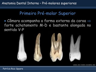 Patrícia Ruiz Spyere
Anatomia Dental Interna – Pré-molares superiores
Primeiro Pré-molar Superior
 Câmara acompanha a forma externa da coroa 
forte achatamento M-D e bastante alongada no
sentido V-P
LEMOS, 2014; SOARES; GOLDBERG, 2002
 