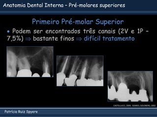 Patrícia Ruiz Spyere
Anatomia Dental Interna – Pré-molares superiores
Primeiro Pré-molar Superior
 Podem ser encontrados três canais (2V e 1P –
7,5%)  bastante finos  difícil tratamento
CASTELLUCCI, 2009; SOARES; GOLDBERG, 2002
 