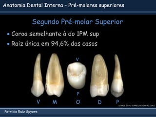 Patrícia Ruiz Spyere
Anatomia Dental Interna – Pré-molares superiores
Segundo Pré-molar Superior
LEMOS, 2014; SOARES; GOLDBERG, 2002
 Coroa semelhante à do 1PM sup
 Raiz única em 94,6% dos casos
V P
D
M O
V
P
 