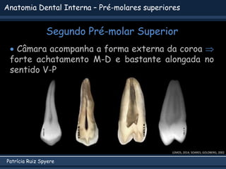 Patrícia Ruiz Spyere
Anatomia Dental Interna – Pré-molares superiores
Segundo Pré-molar Superior
 Câmara acompanha a forma externa da coroa 
forte achatamento M-D e bastante alongada no
sentido V-P
LEMOS, 2014; SOARES; GOLDBERG, 2002
 