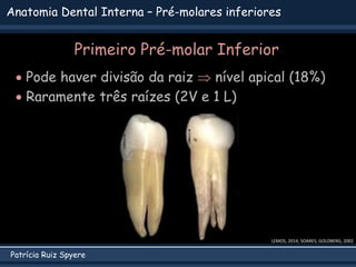 Patrícia Ruiz Spyere
Anatomia Dental Interna – Pré-molares inferiores
Primeiro Pré-molar Inferior
 Pode haver divisão da ...