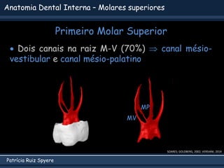 Patrícia Ruiz Spyere
Anatomia Dental Interna – Molares superiores
Primeiro Molar Superior
 Dois canais na raiz M-V (70%) ...
