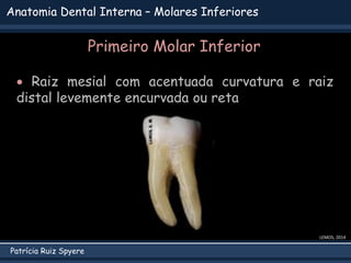 Patrícia Ruiz Spyere
Anatomia Dental Interna – Molares Inferiores
LEMOS, 2014
 Raiz mesial com acentuada curvatura e raiz...