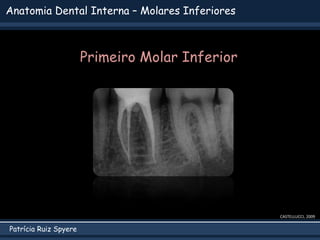Patrícia Ruiz Spyere
Anatomia Dental Interna – Molares Inferiores
CASTELLUCCI, 2009
Primeiro Molar Inferior
 