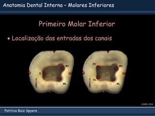 Patrícia Ruiz Spyere
Anatomia Dental Interna – Molares Inferiores
LEMOS, 2014
 Localização das entradas dos canais
Primei...