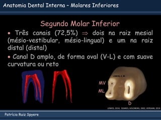 Patrícia Ruiz Spyere
Anatomia Dental Interna – Molares Inferiores
 Três canais (72,5%)  dois na raiz mesial
(mésio-vesti...