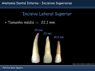 Patrícia Ruiz Spyere
Anatomia Dental Interna – Incisivos Superiores
Incisivo Lateral Superior
 Tamanho médio  22,1 mm
29...