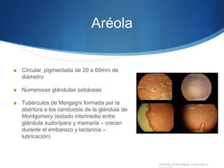 Aréola
S Circular, pigmentada de 20 a 60mm de
diámetro
S Numerosas glándulas sebáceas
S Tubérculos de Morgagni formada por la
abertura e los conductos de la glándula de
Montgomery (estado intermedio entre
glándula sudorípara y mamaria – crecen
durante el embarazo y lactancia –
lubricación)
Patology of the breast. Fatteaneh-a,
 