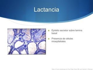 Lactancia
S Epitelio secretor sobre lamina
basal
S Presencia de células
mioepiteliales
Atlas of tumor phatology by Paul Peter Roen MD and Harold A Obeman
 