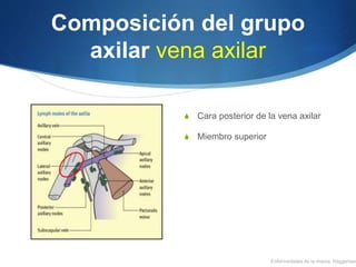 Composición del grupo
axilar vena axilar
S Cara posterior de la vena axilar
S Miembro superior
Enfermedades de la mama, Haggensen
 