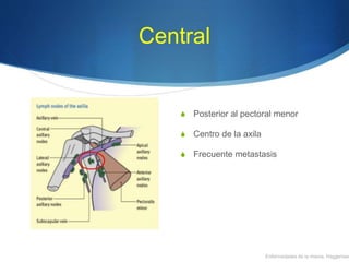 Central
S Posterior al pectoral menor
S Centro de la axila
S Frecuente metastasis
Enfermedades de la mama, Haggensen
 