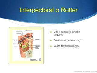 Interpectoral o Rotter
S Uno a cuatro de tamaño
pequeño
S Posterior al pectoral mayor
S Vasos toracoacromiales
Enfermedades de la mama, Haggensen
 