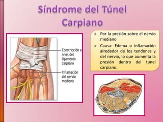 » Por la presión sobre el nervio
mediano
» Causa: Edema o inflamación
alrededor de los tendones y
del nervio, lo que aumenta la
presión dentro del túnel
carpiano.
 