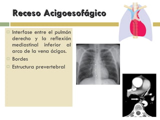 Anatomia Mediastino | PPT