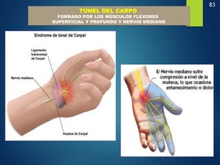 83
TÚNEL DEL CARPO
FORMADO POR LOS MÚSCULOS FLEXORES
SUPERFICIAL Y PROFUNDO Y NERVIO MEDIANO
 