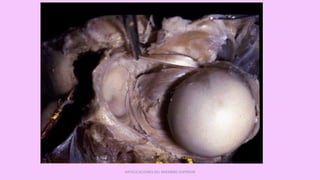 ARTICULACIONES DEL MIEMBRO SUPERIOR
 