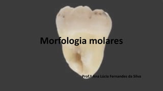 Morfologia molares
Prof.ª Ana Lúcia Fernandes da Silva
 