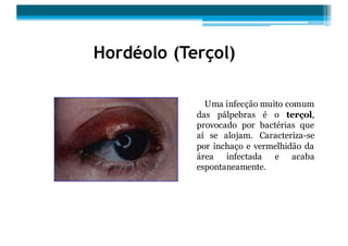 Hordeolo Anatomia ocular.pdf