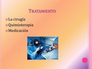 TRATAMIENTO
La cirugía
Quimioterapia
Medicación
 